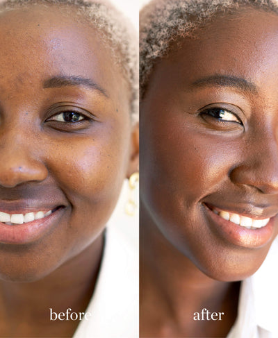 Comparison of coverage of natural arnica all-cover concealer on skin for an even complexion
